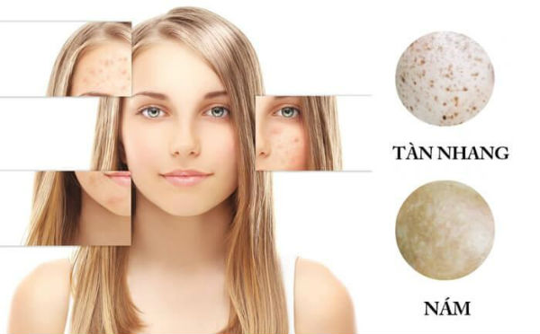 cách điều trị nám hiệu quả