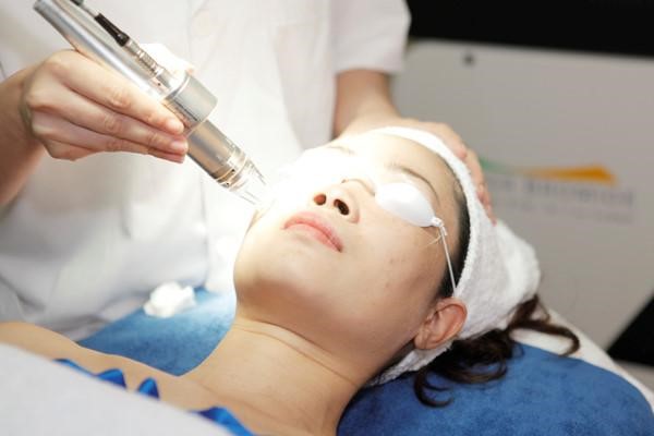 cách điều trị nám hiệu quả