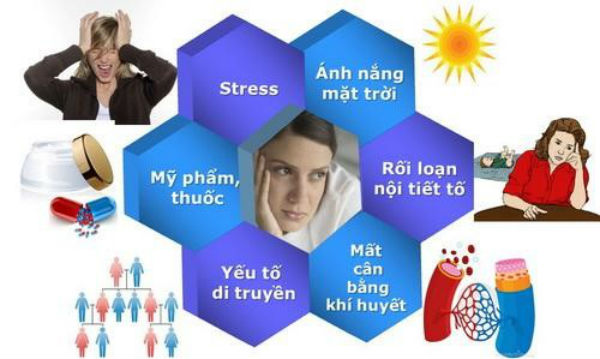 cách điều trị nám hiệu quả