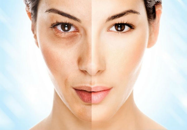 điều trị nám ở đâu