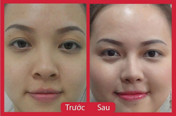 phẩu thuật thẩm mỹ