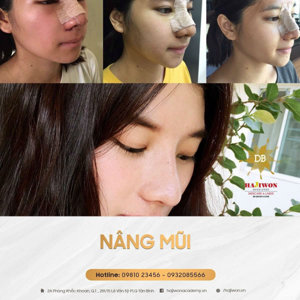 phẩu thuật thẩm mỹ