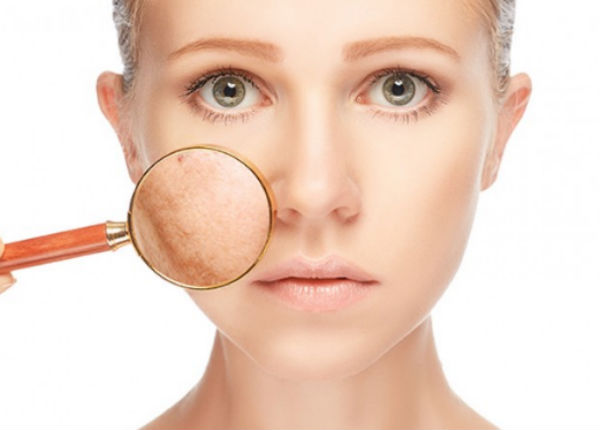 phương pháp điều trị nám hiệu quả nhất